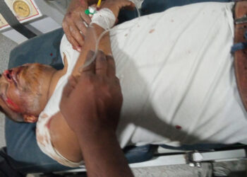 بہار:راشٹریہ جنتادل لیڈر فروغ عالم جامی سڑک حادثہ میں زخمی