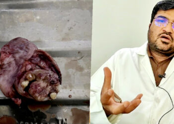 الشفا ہاسپٹل میں ایڈوانس مائیکرو اسکوپک سرجری